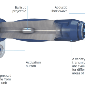 Best shockwave therapy machine