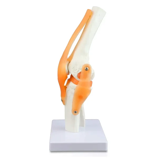Knee Model for Surgical Planning