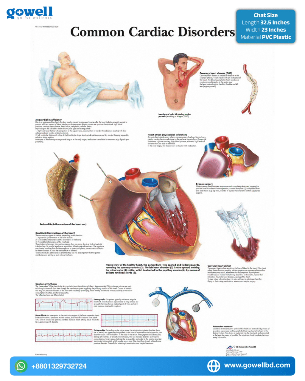 Common Cardiac Disorders Chart