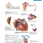 Common Cardiac Disorders Poster — Heart Conditions Chart