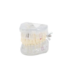 Transparent Dental Implant Teeth Model Dentist Standard Disease Removable Tooth Pathological Teaching Model
