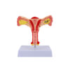 Uterine Model
