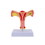 Uterine Model