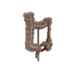 Colorectal Lesion Model Human Colon Snake