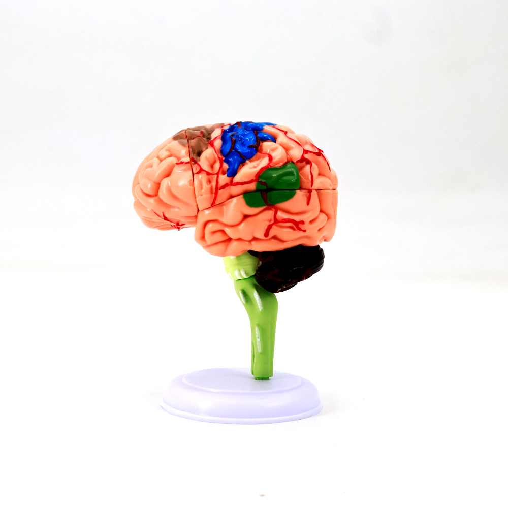 Human Brain Anatomical Model with Pathologies