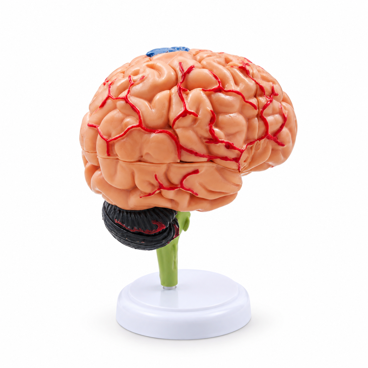 Human Brain Anatomical Model with Pathologies